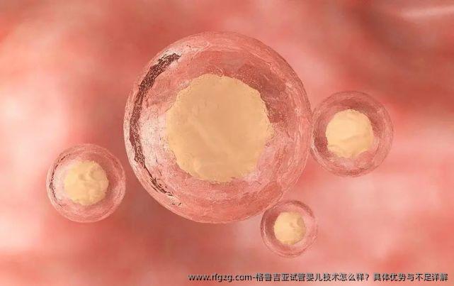 格鲁吉亚代孕技术怎么样？具体优势与不足详解