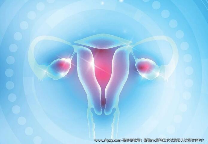 高龄做试管！泰国nic医院三代代孕过程咋样的？