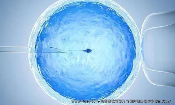 柬埔寨代孕与国内相比成功率差别大吗？