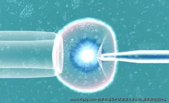 俄罗斯做三代代孕多少钱,具体流程是什么