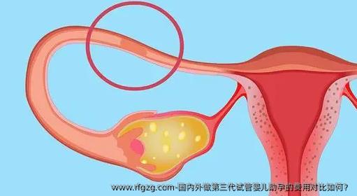 国内外做第三代代孕助孕的费用对比如何？
