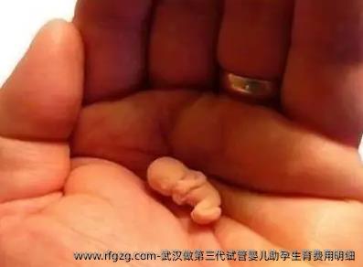 武汉做第三代试管婴儿助孕生育费用明细