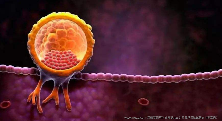 耳聋基因可以代孕么？耳聋基因做试管成功率高吗？ 