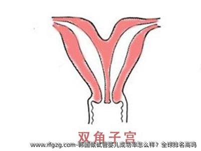 韩国做代孕成功率怎么样？全球排名高吗