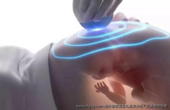 国外做代孕要多少钱？大概费用指南