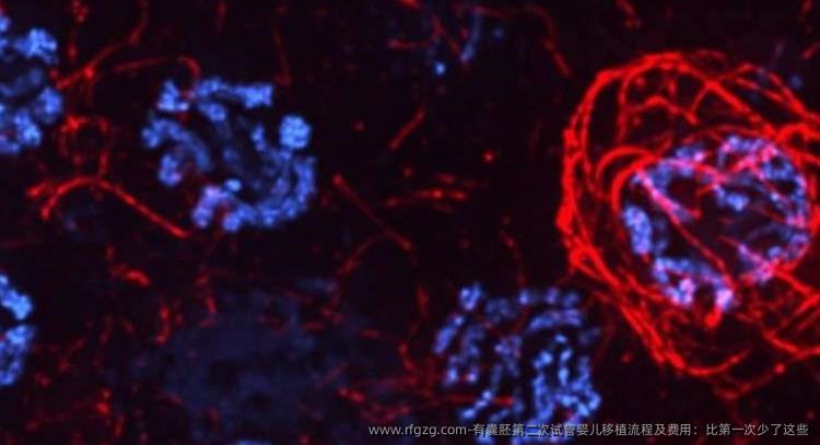 有囊胚第二次代孕移植流程及费用：比第一次少了这些